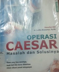 Image of Operasi Caesar masalah dan solusinya