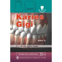 Image of Karies gigi [Edisi 2]